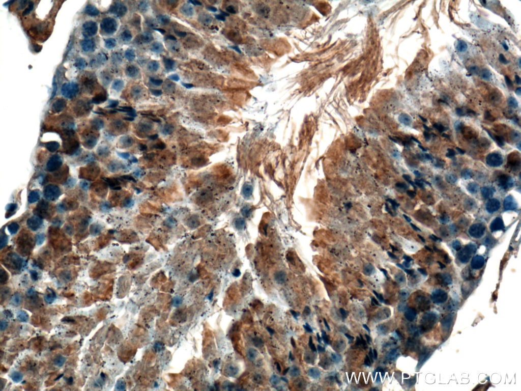 Immunohistochemistry (IHC) staining of mouse testis tissue using GNRHR Polyclonal antibody (22462-1-AP)