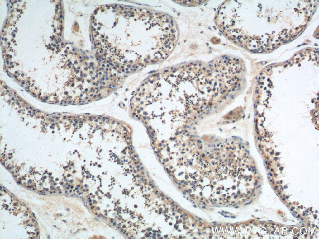 IHC staining of human testis using 22462-1-AP