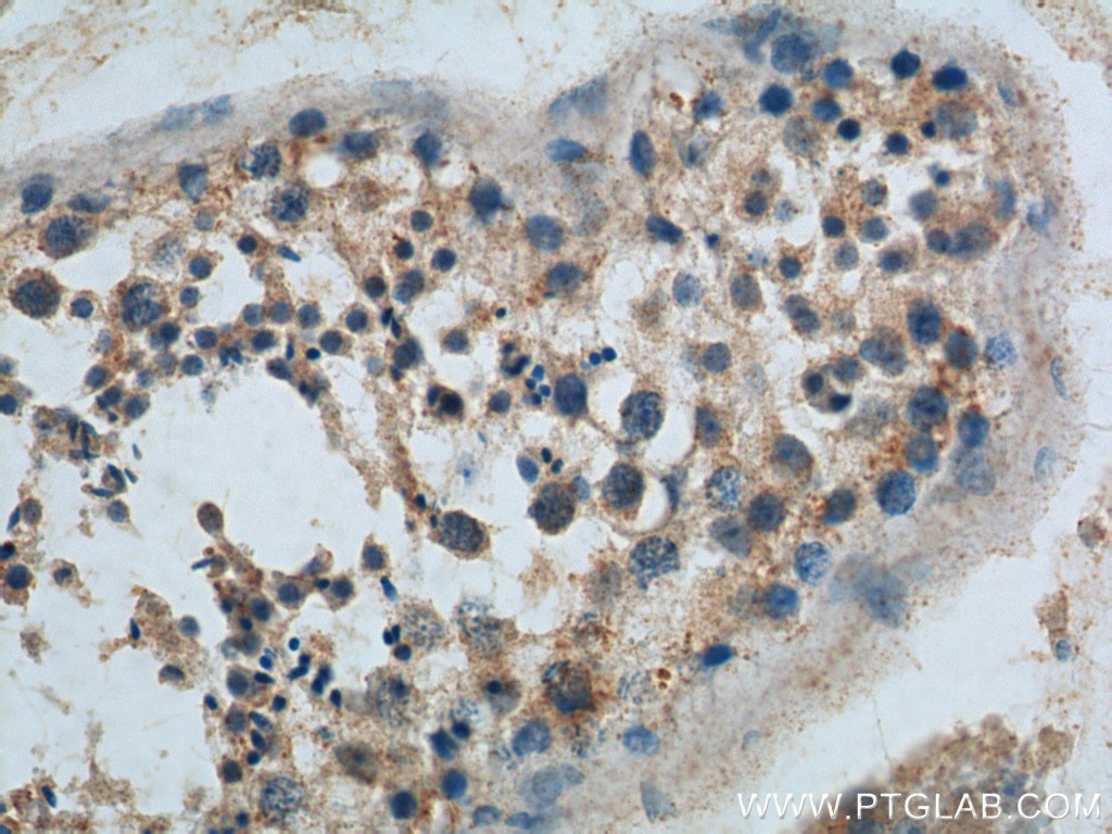 Immunohistochemistry (IHC) staining of human testis tissue using GNRHR Polyclonal antibody (22462-1-AP)