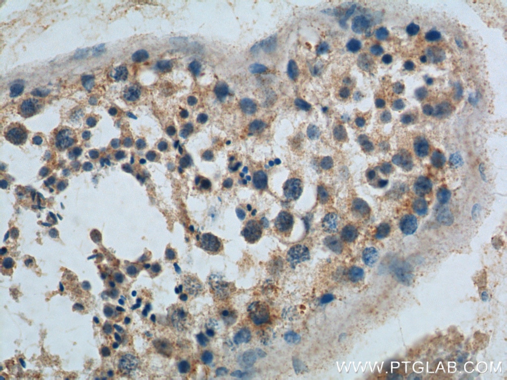 IHC staining of human testis using 22462-1-AP