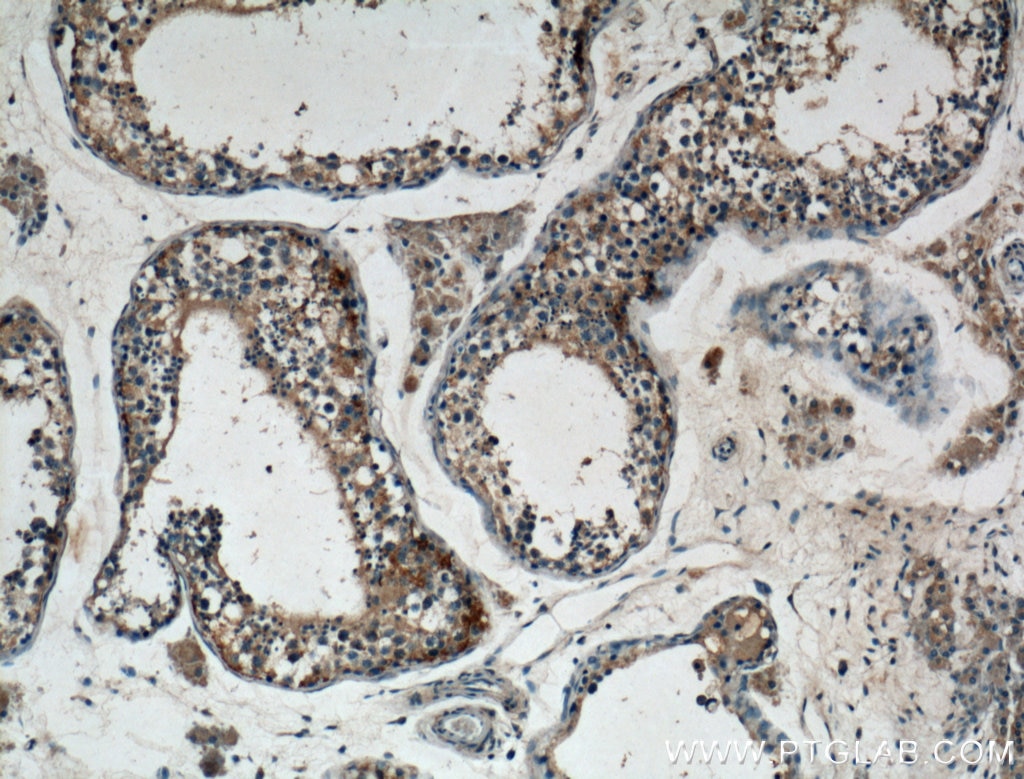 Immunohistochemistry (IHC) staining of human testis tissue using GNRHR Polyclonal antibody (22462-1-AP)