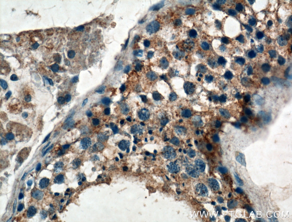 Immunohistochemistry (IHC) staining of human testis tissue using GNRHR Polyclonal antibody (22462-1-AP)