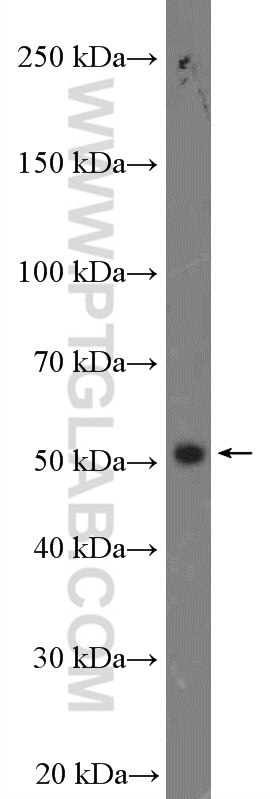 Western Blot (WB) analysis of mouse testis tissue using GNRHR Polyclonal antibody (22462-1-AP)