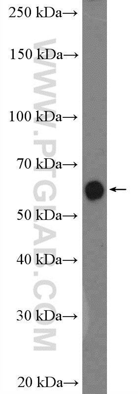 Western Blot (WB) analysis of mouse ovary tissue using GNRHR Polyclonal antibody (22462-1-AP)