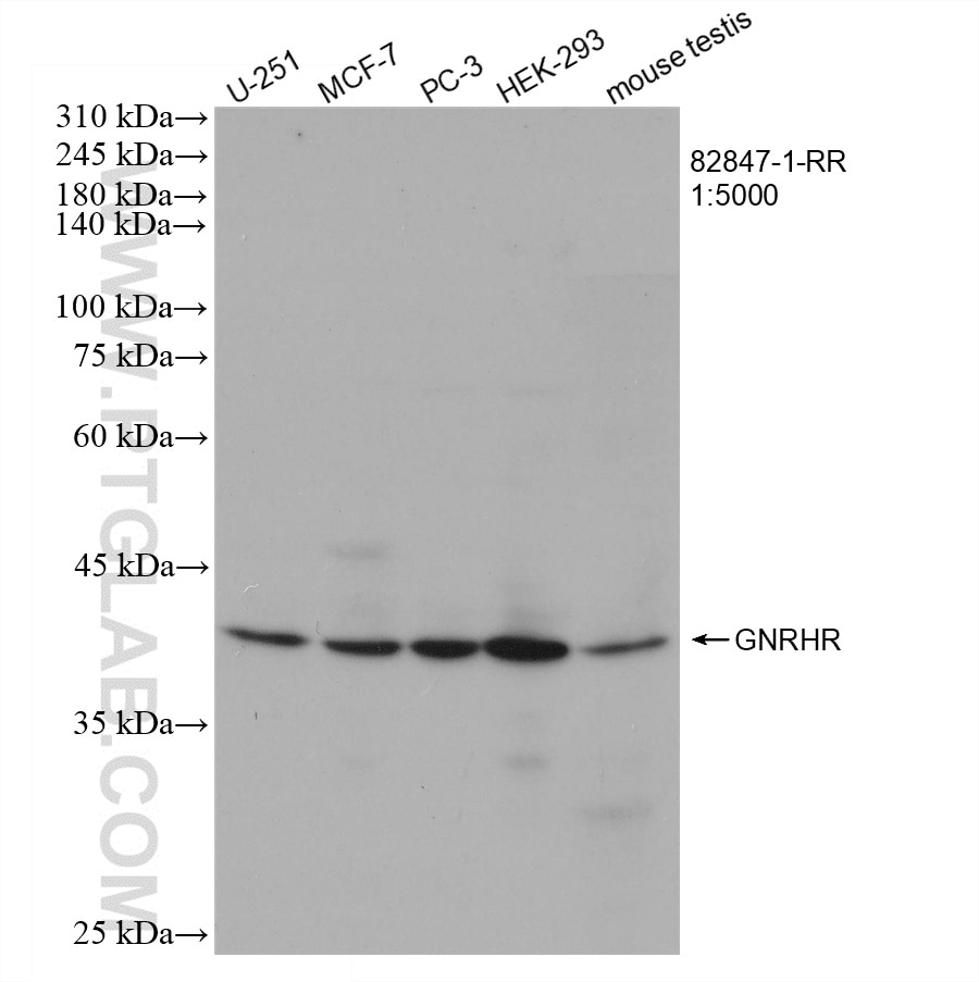 Western Blot (WB) analysis of various lysates using GNRHR Recombinant antibody (82847-1-RR)