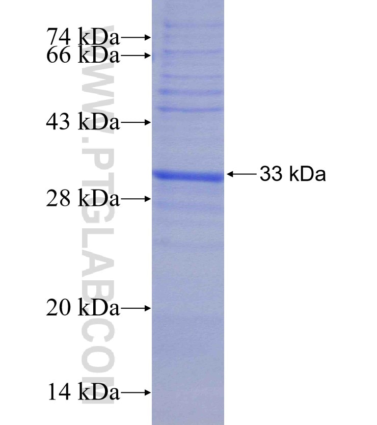 GNRHR fusion protein Ag18005 SDS-PAGE
