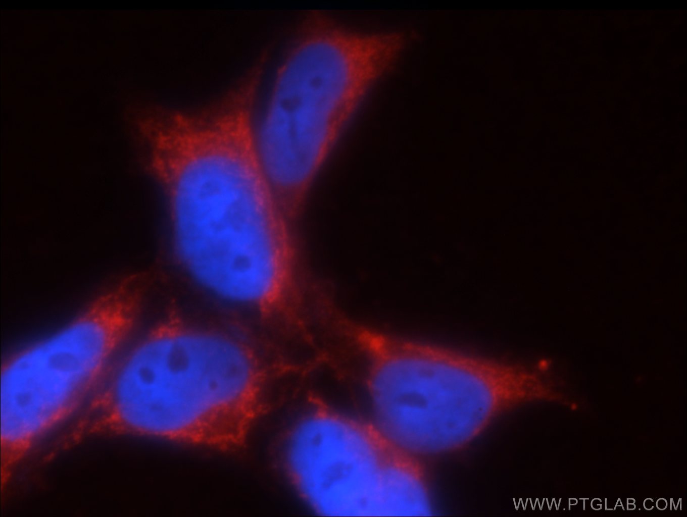 IF Staining of HEK-293 using 20728-1-AP