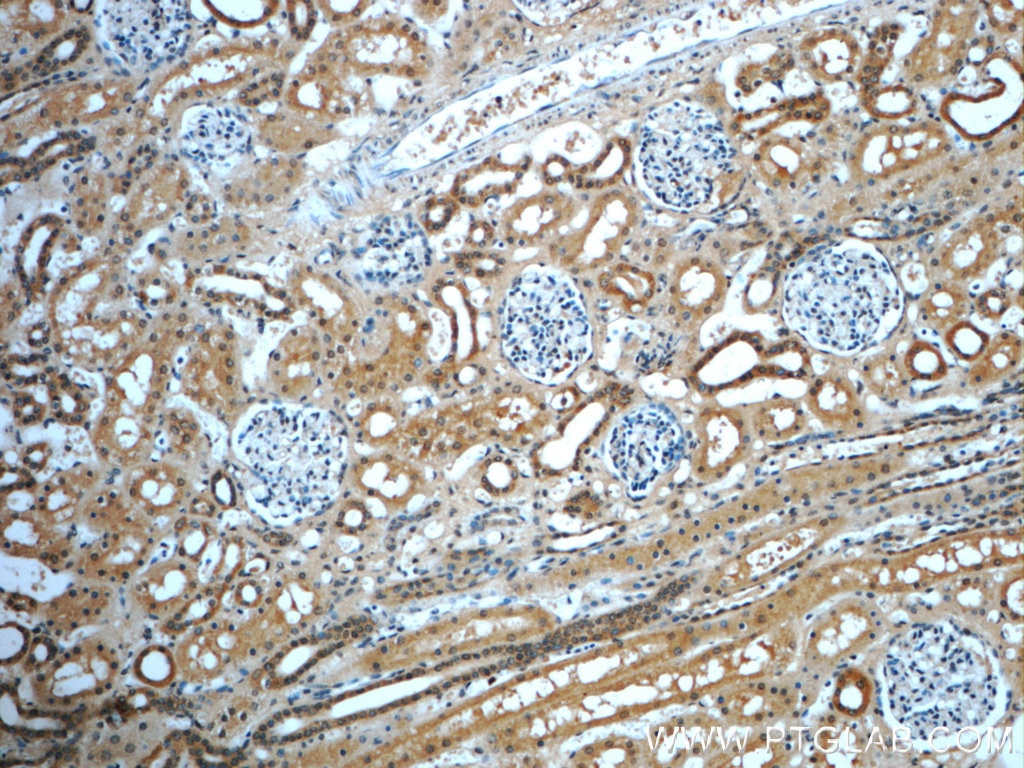 Immunohistochemistry (IHC) staining of human kidney tissue using GNRHR2 Polyclonal antibody (20728-1-AP)