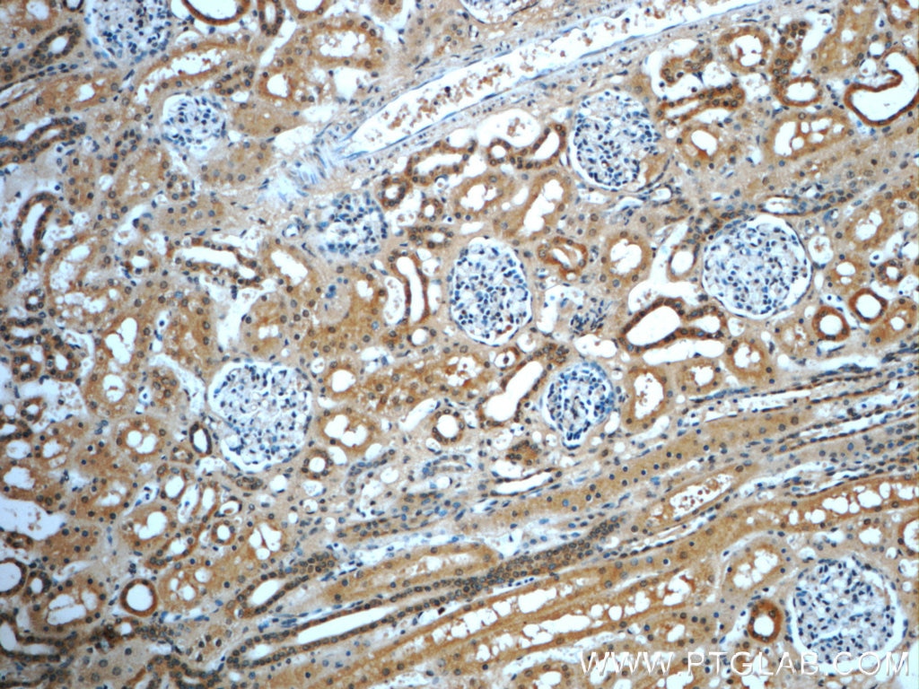 Immunohistochemistry (IHC) staining of human kidney tissue using GNRHR2 Polyclonal antibody (20728-1-AP)