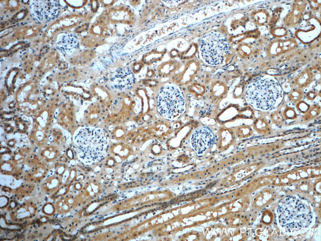 IHC staining of human kidney using 20728-1-AP