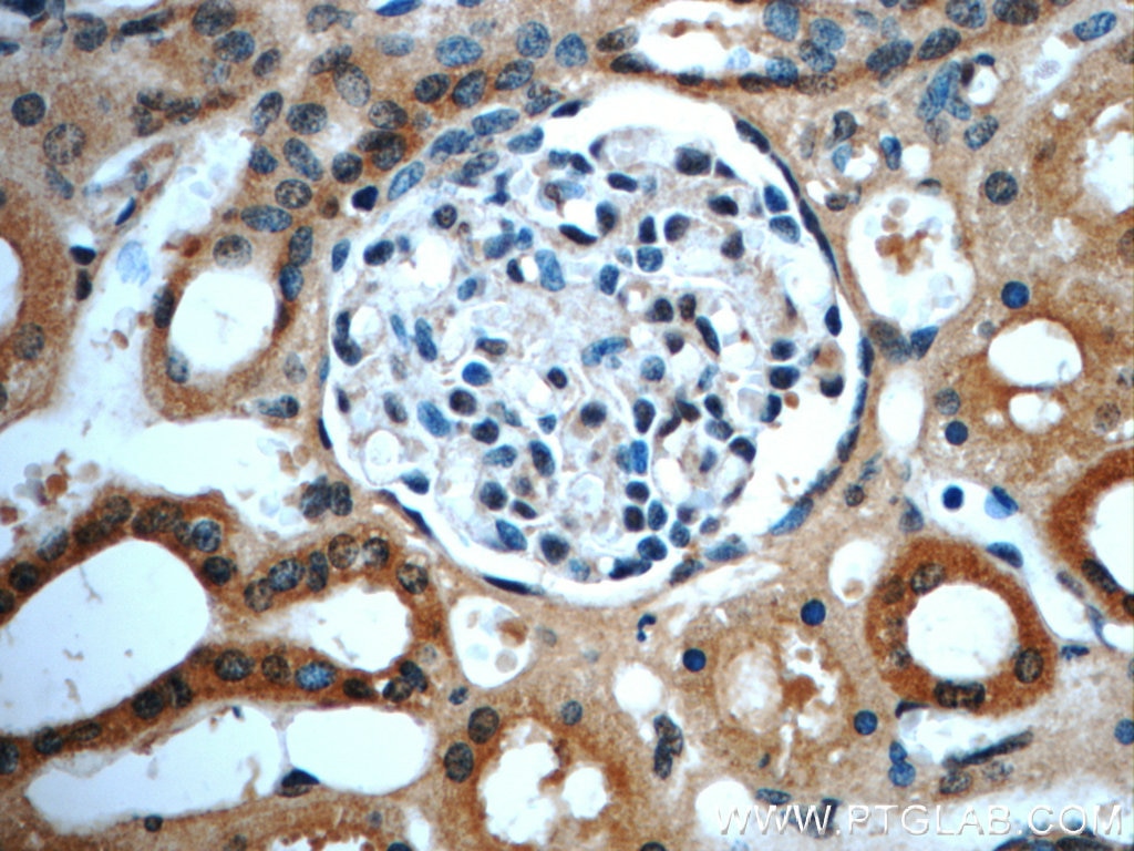 Immunohistochemistry (IHC) staining of human kidney tissue using GNRHR2 Polyclonal antibody (20728-1-AP)