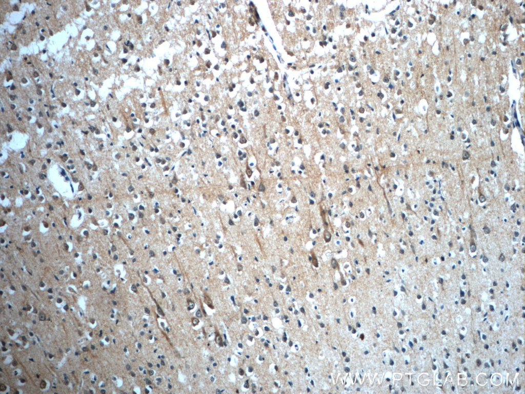 Immunohistochemistry (IHC) staining of human brain tissue using GNRHR2 Polyclonal antibody (20728-1-AP)