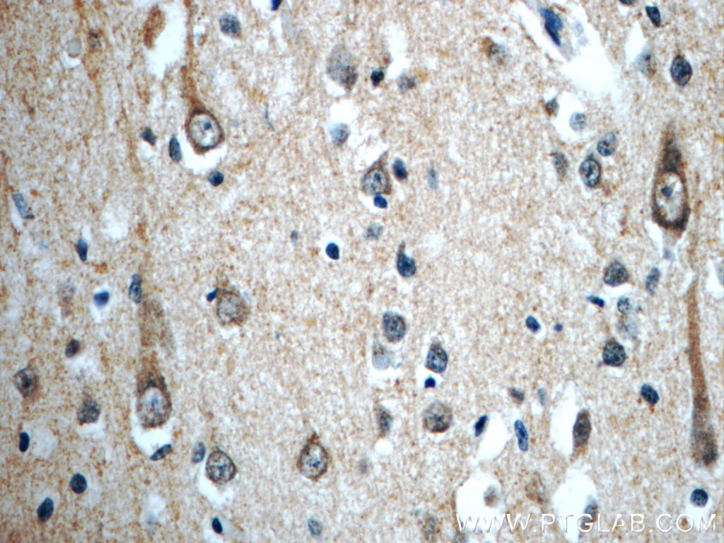 Immunohistochemistry (IHC) staining of human brain tissue using GNRHR2 Polyclonal antibody (20728-1-AP)