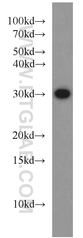 Western Blot (WB) analysis of human stomach tissue using GNRHR2 Polyclonal antibody (20728-1-AP)