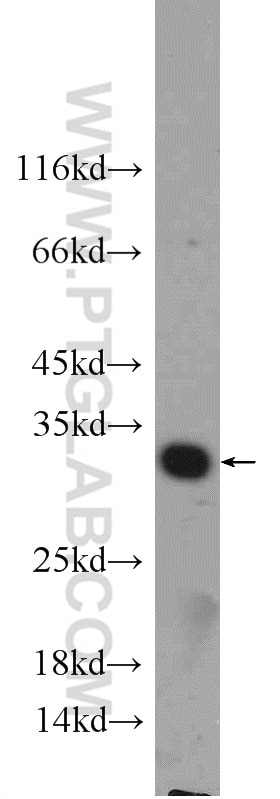 Western Blot (WB) analysis of human placenta tissue using GNRHR2 Polyclonal antibody (20728-1-AP)