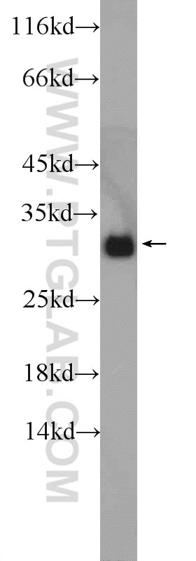 Western Blot (WB) analysis of human brain tissue using GNRHR2 Polyclonal antibody (20728-1-AP)