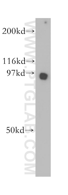 Western Blot (WB) analysis of HeLa cells using GNS Polyclonal antibody (13044-1-AP)