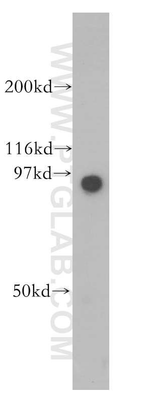 Western Blot (WB) analysis of PC-3 cells using GNS Polyclonal antibody (13044-1-AP)