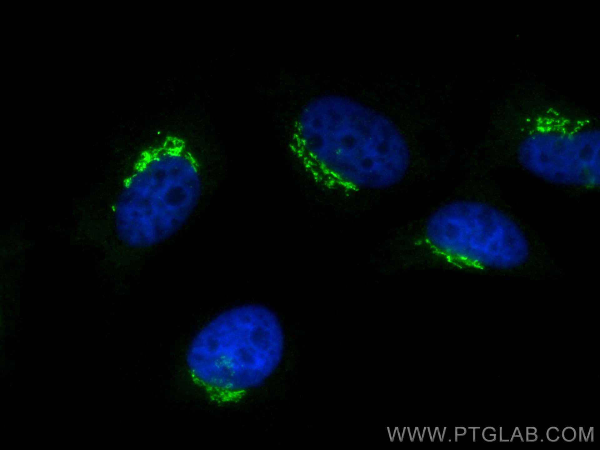 Immunofluorescence (IF) / fluorescent staining of HeLa cells using golgin 97 Polyclonal antibody (12640-1-AP)