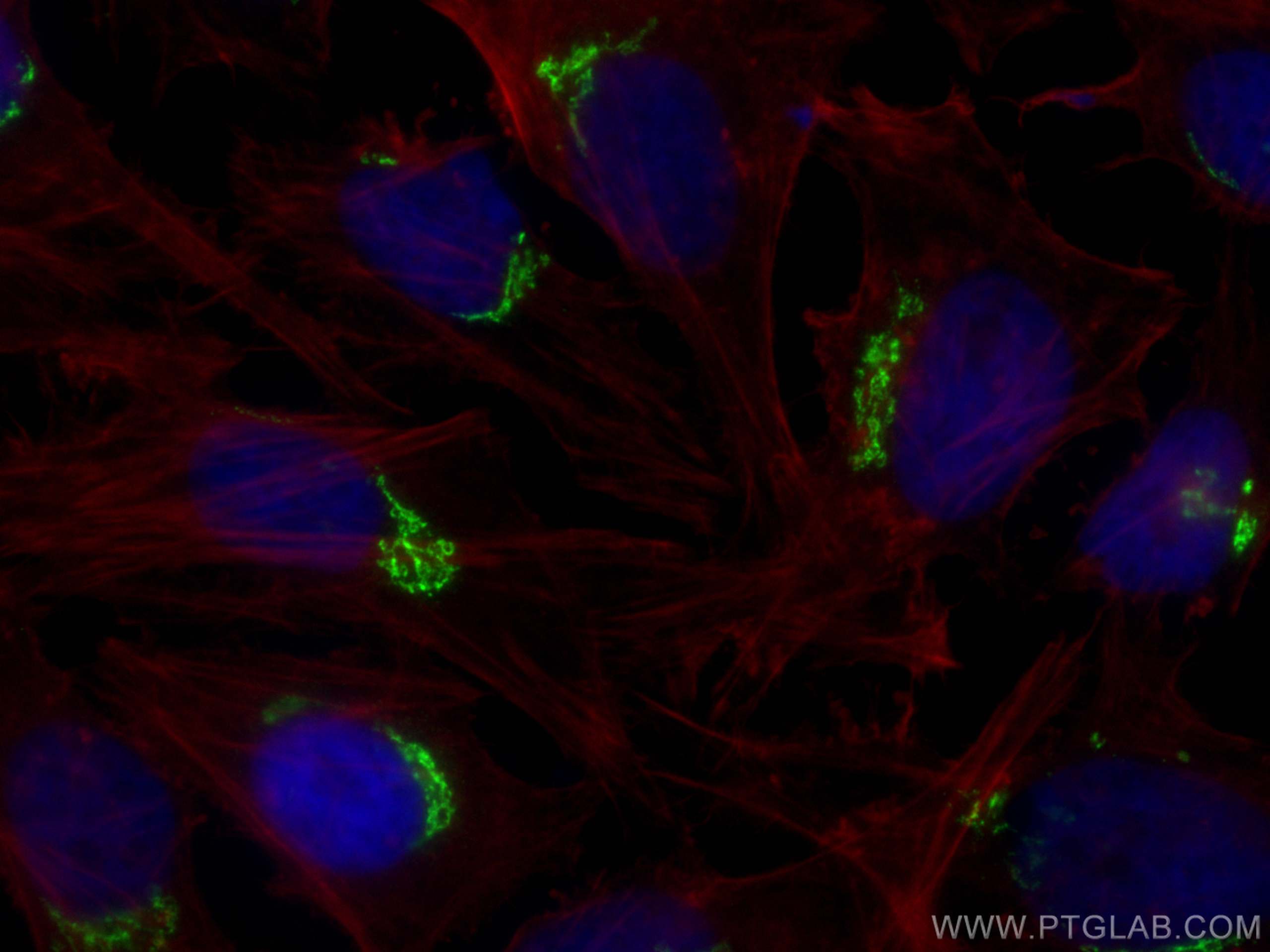 Immunofluorescence (IF) / fluorescent staining of HeLa cells using golgin 97 Polyclonal antibody (12640-1-AP)