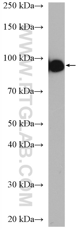 Western Blot (WB) analysis of SMMC-7721 cells using golgin 97 Polyclonal antibody (12640-1-AP)