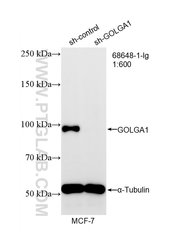 WB analysis of MCF-7 using 68648-1-Ig Western Blot (WB) analysis of MCF-7 cells using golgin 97 Monoclonal antibody (68648-1-Ig)