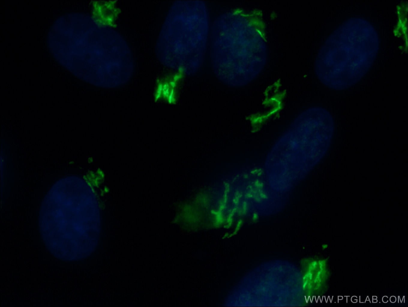 Immunofluorescence (IF) / fluorescent staining of MDCK cells using GOLGA2/GM130 Polyclonal antibody (11308-1-AP)
