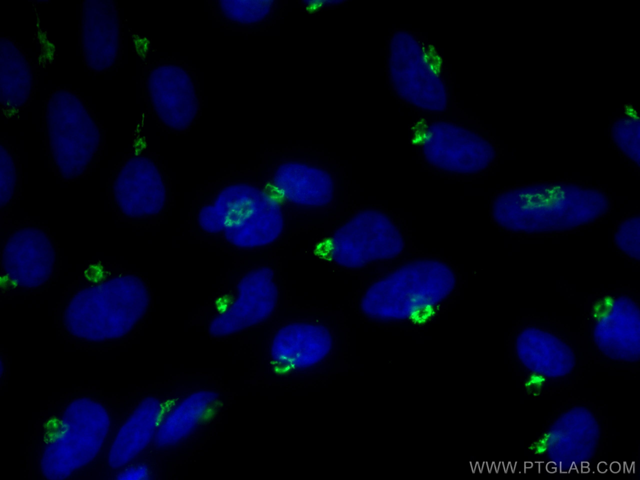 Immunofluorescence (IF) / fluorescent staining of HEK-293 cells using GOLGA2/GM130 Polyclonal antibody (11308-1-AP)