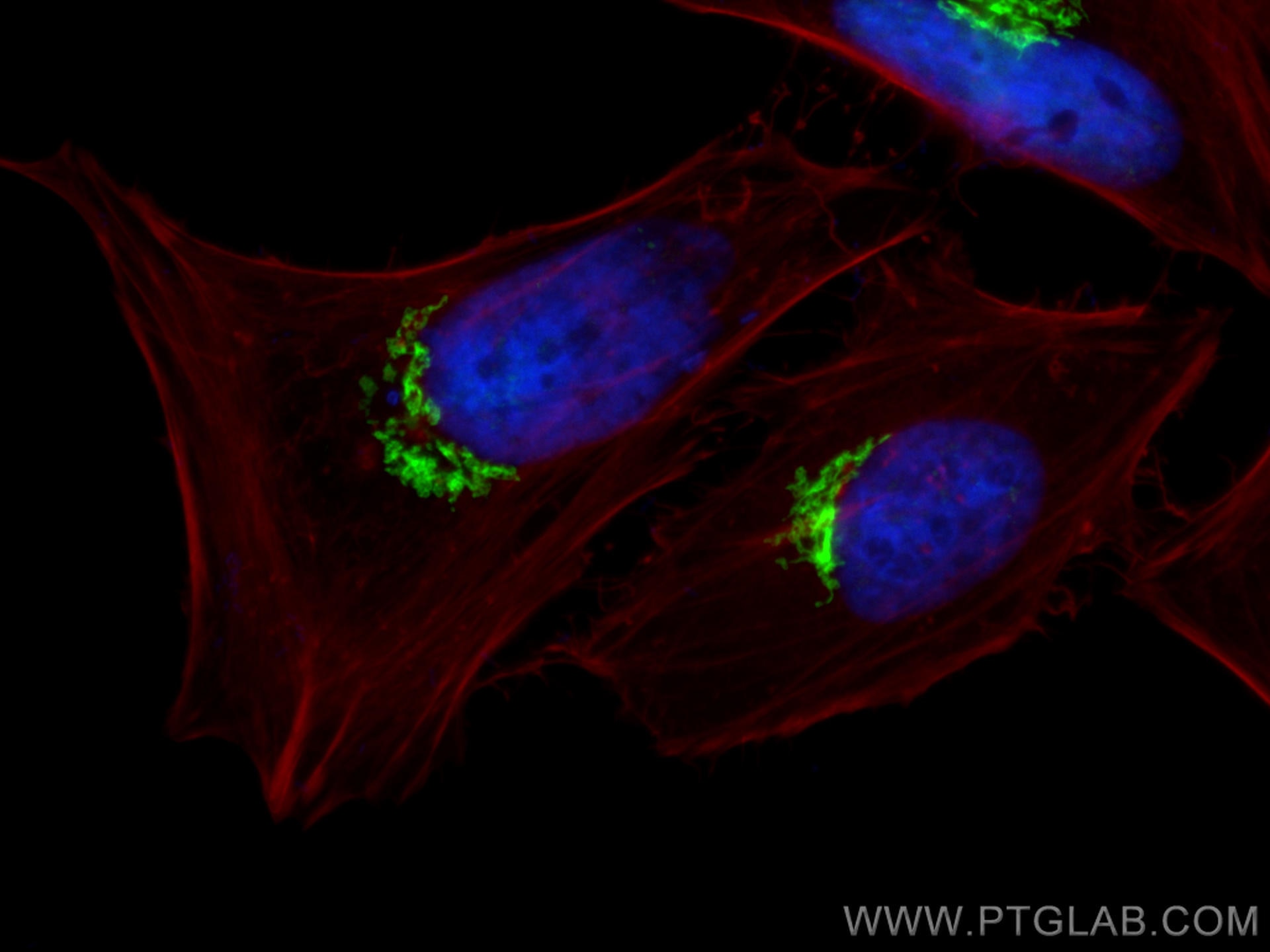 Immunofluorescence (IF) / fluorescent staining of HeLa cells using GOLGA2/GM130 Polyclonal antibody (11308-1-AP)