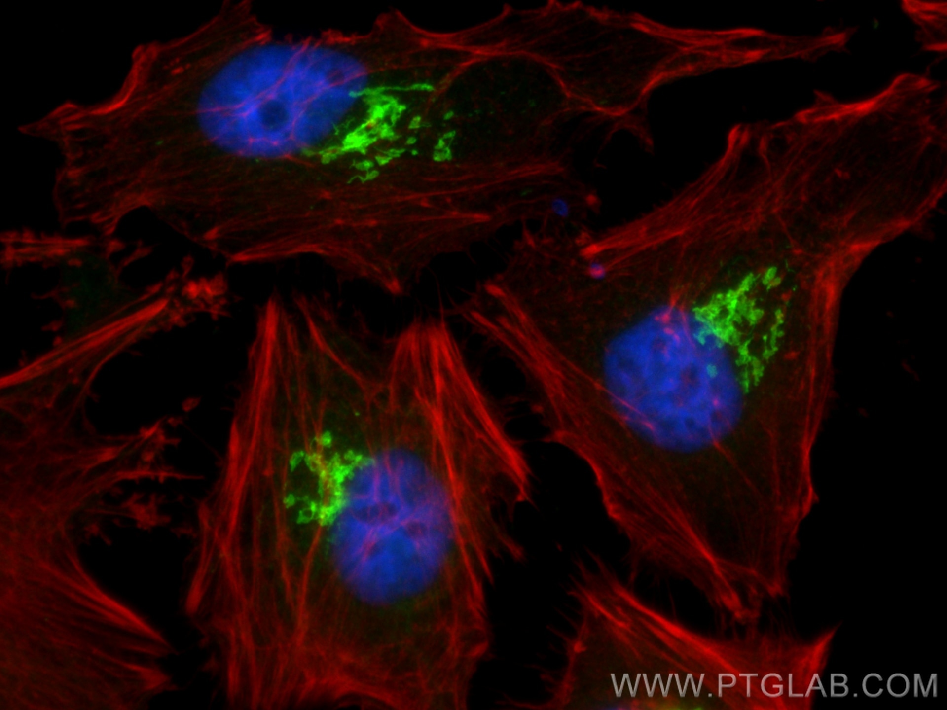 Immunofluorescence (IF) / fluorescent staining of HeLa cells using GOLGA2/GM130 Polyclonal antibody (11308-1-AP)