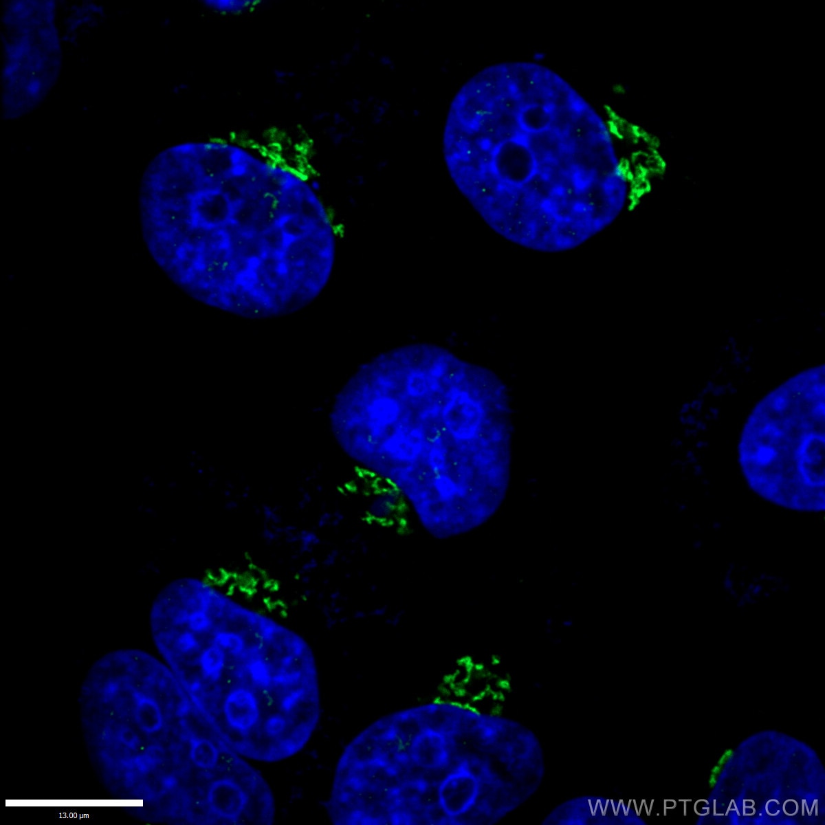 IF Staining of HepG2 using 11308-1-AP