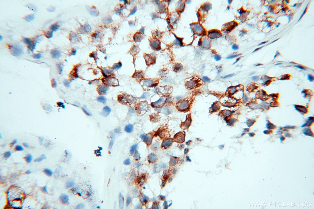 Immunohistochemistry (IHC) staining of human testis tissue using GOLGA2/GM130 Polyclonal antibody (11308-1-AP)