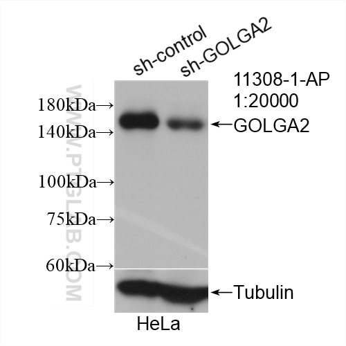 Western Blot (WB) analysis of HeLa cells using GOLGA2/GM130 Polyclonal antibody (11308-1-AP)