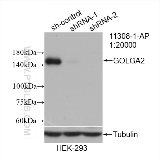 Western Blot (WB) analysis of HEK-293 cells using GOLGA2/GM130 Polyclonal antibody (11308-1-AP)