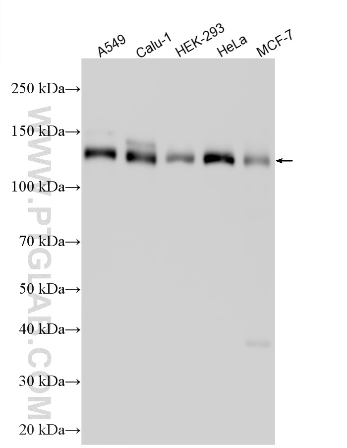 Western Blot (WB) analysis of various lysates using GOLGA2/GM130 Polyclonal antibody (11308-1-AP)
