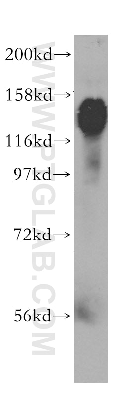 GOLGA2/GM130 Polyclonal antibody