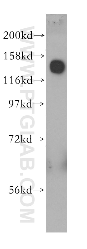 Western Blot (WB) analysis of human spleen tissue using GOLGA2/GM130 Polyclonal antibody (11308-1-AP)