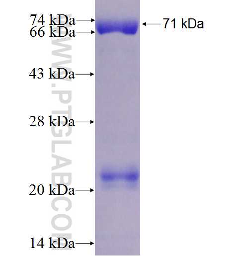 GM130;GOLGA2 fusion protein Ag1848 SDS-PAGE