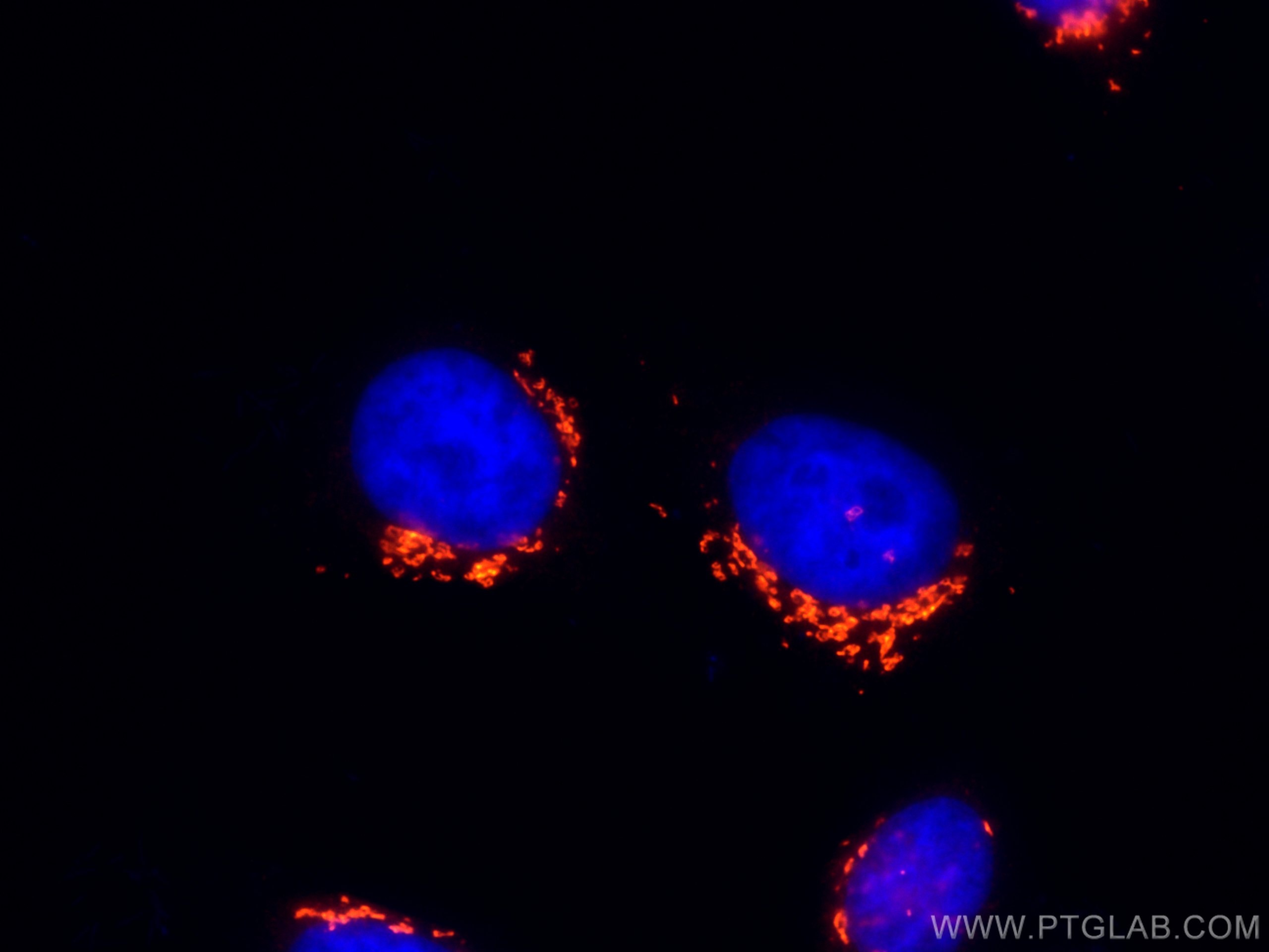 IF Staining of HepG2 using CL555-11308