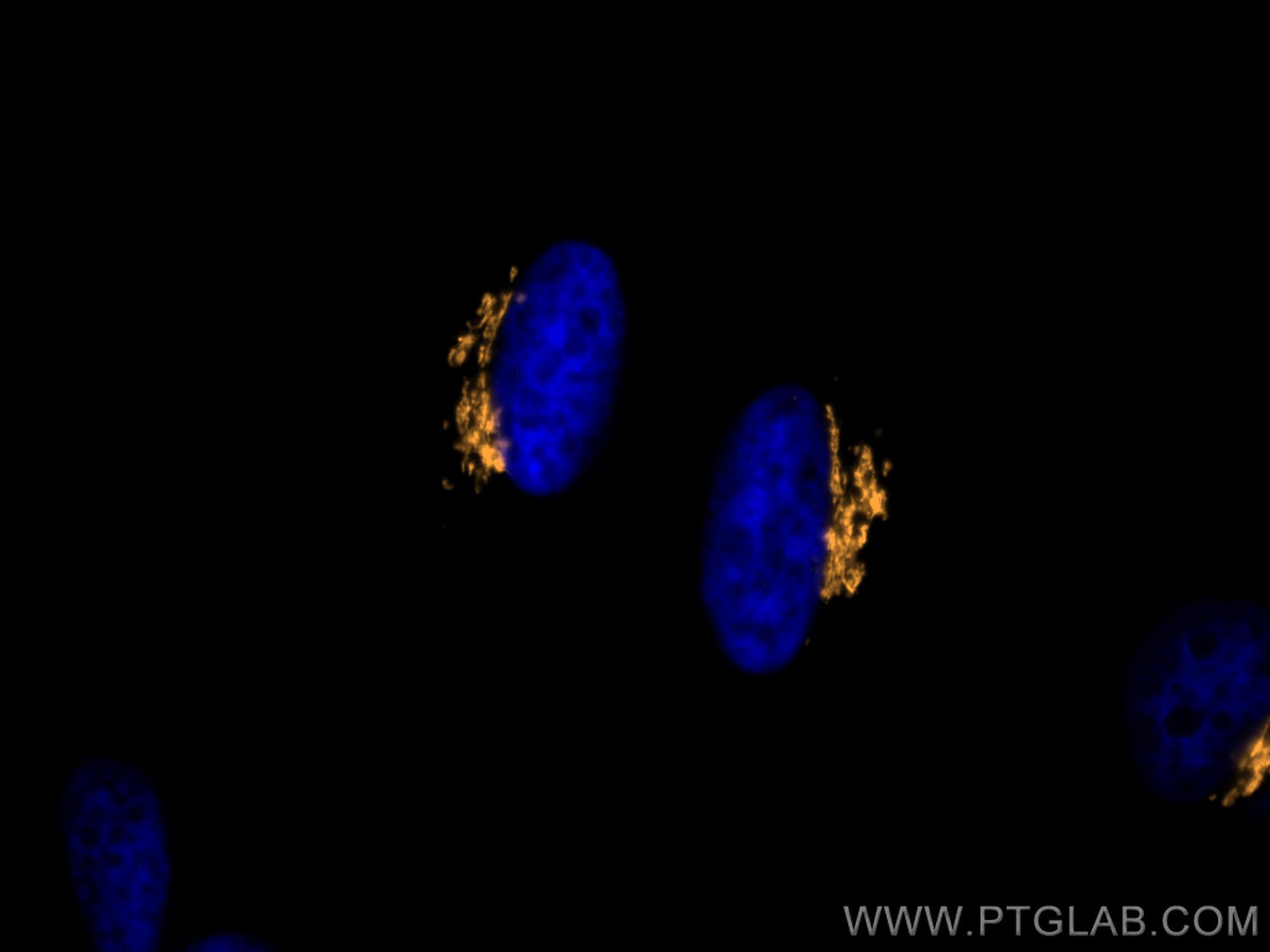 IF Staining of HeLa using CL555-11308