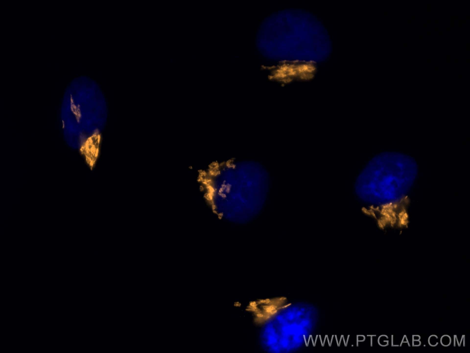 Immunofluorescence (IF) / fluorescent staining of HeLa cells using CoraLite®555-conjugated GOLGA2/GM130 Polyclonal an (CL555-11308)