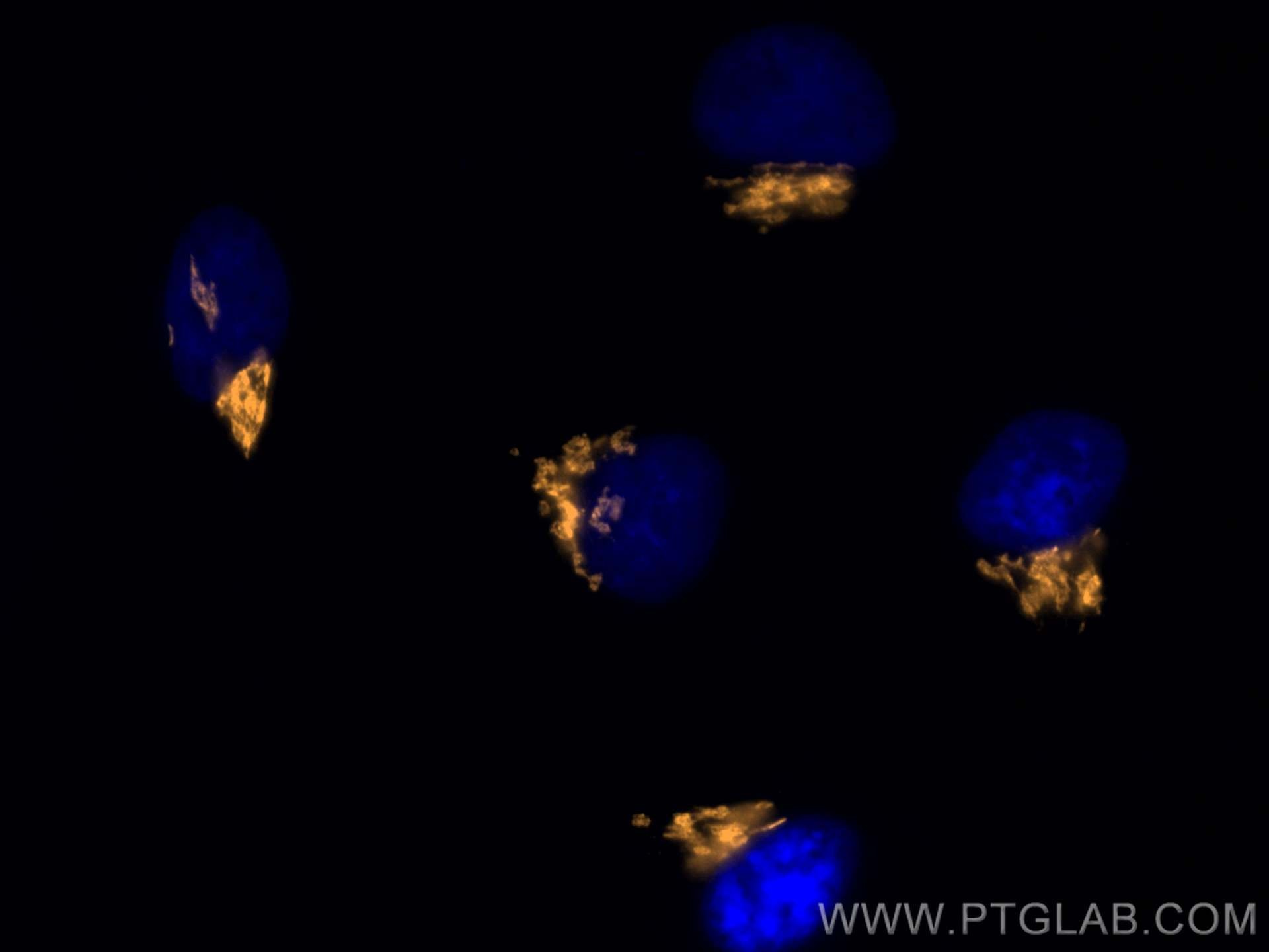 IF Staining of HeLa using CL555-11308