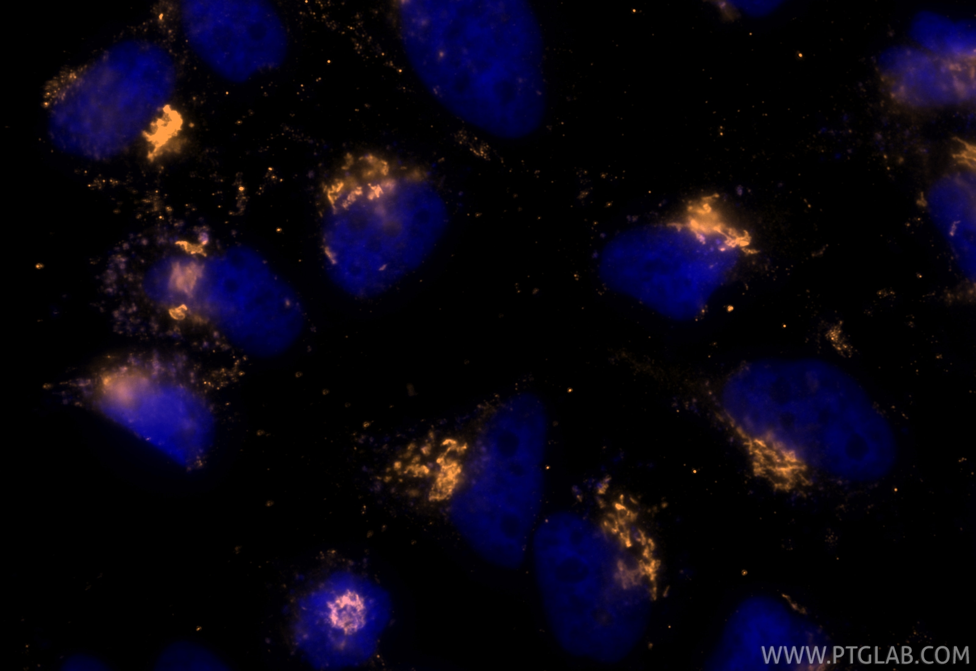 Immunofluorescence (IF) / fluorescent staining of HeLa cells using CoraLite® Plus 555-conjugated GOLGA2/GM130 Recombi (CL555-82705-8)