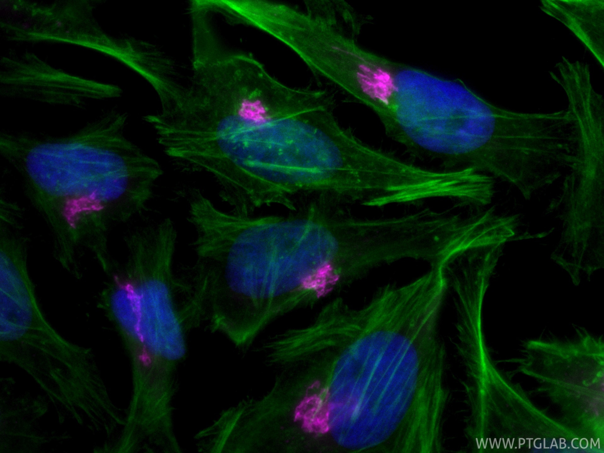 IF Staining of HeLa using CL647-11308 Immunofluorescence (IF) / fluorescent staining of HeLa cells using CoraLite® Plus 647-conjugated GOLGA2/GM130 Polyclo (CL647-11308)