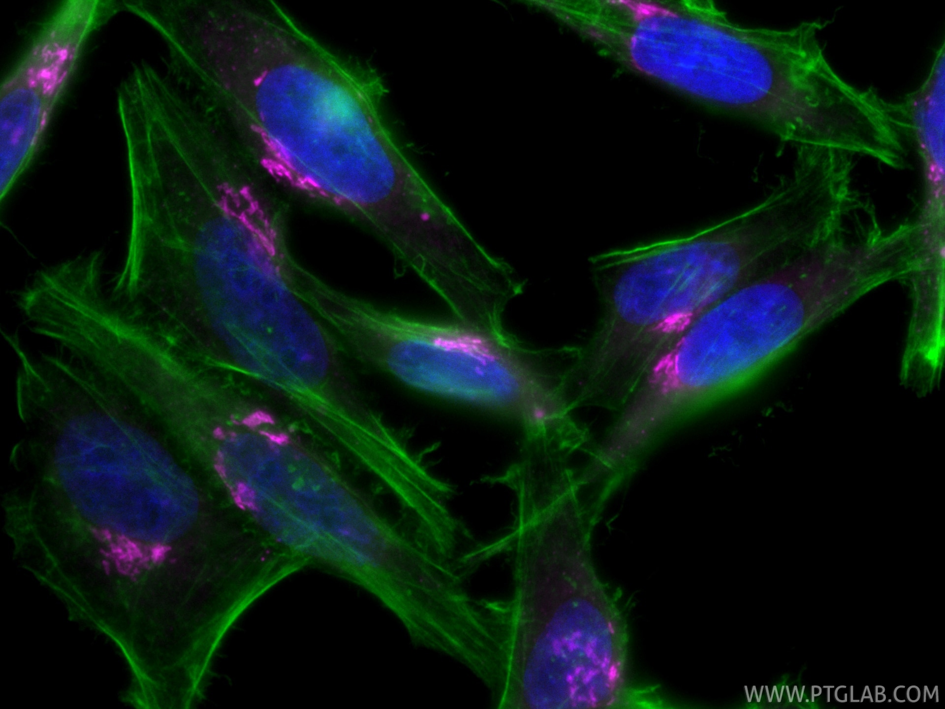 IF Staining of HepG2 using CL647-11308 Immunofluorescence (IF) / fluorescent staining of HepG2 cells using CoraLite® Plus 647-conjugated GOLGA2/GM130 Polyclo (CL647-11308)