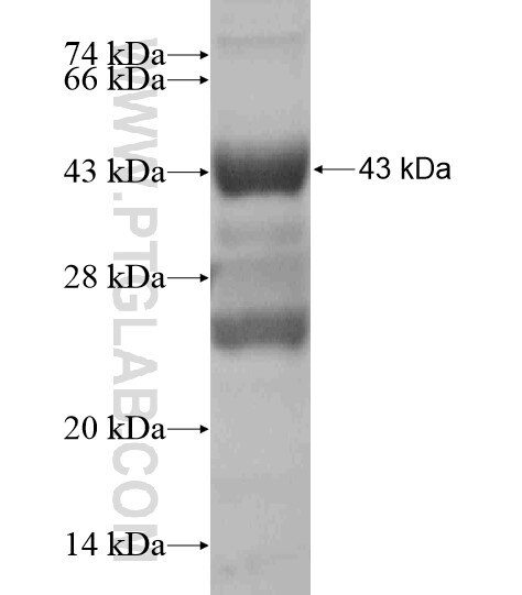 GOLGA2L1 fusion protein Ag19521 SDS-PAGE GOLGA2L1 fusion protein Ag19521 SDS-PAGE