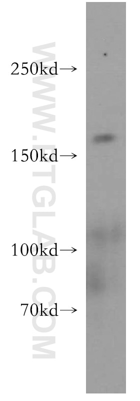 Western Blot (WB) analysis of human heart tissue using GOLGA3 Polyclonal antibody (21193-1-AP)