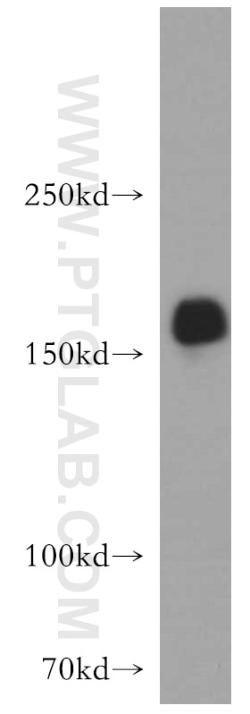 Western Blot (WB) analysis of PC-3 cells using GOLGA3 Polyclonal antibody (21193-1-AP)