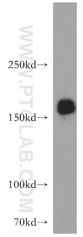 WB analysis of PC-3 using 21193-1-AP