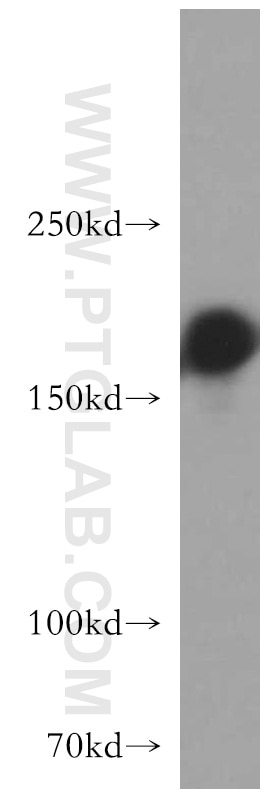 Western Blot (WB) analysis of L02 cells using GOLGA3 Polyclonal antibody (21193-1-AP)